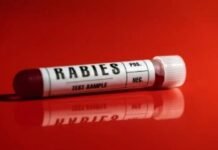 लुधियाना में रैबीज़ अलर्ट के बीच राहत, जगराओं से रेफर किए गए सभी 7 मरीज सुरक्षित